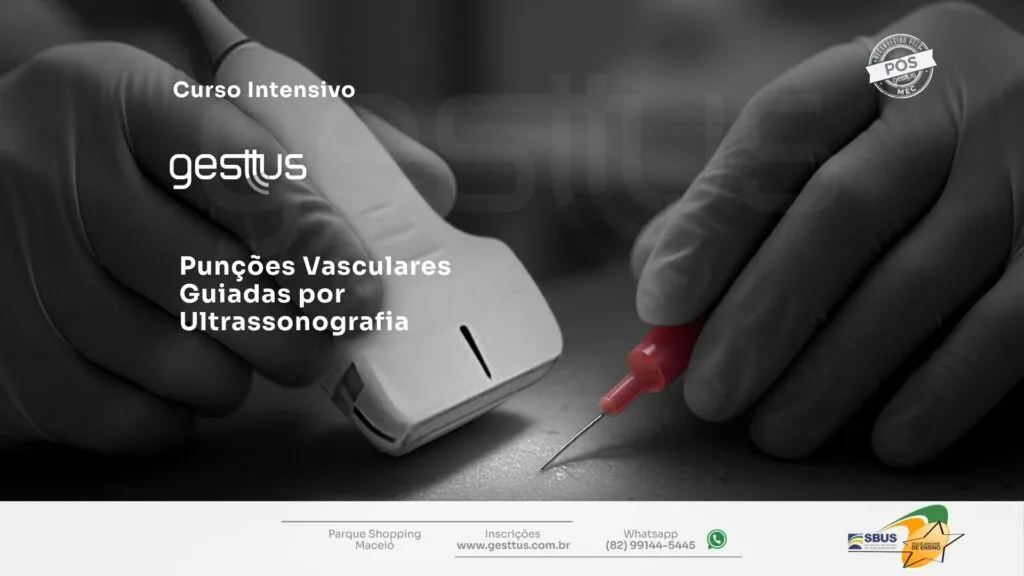 Punções Vasculares Guiadas por USG