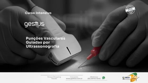 Punções Vasculares Guiadas